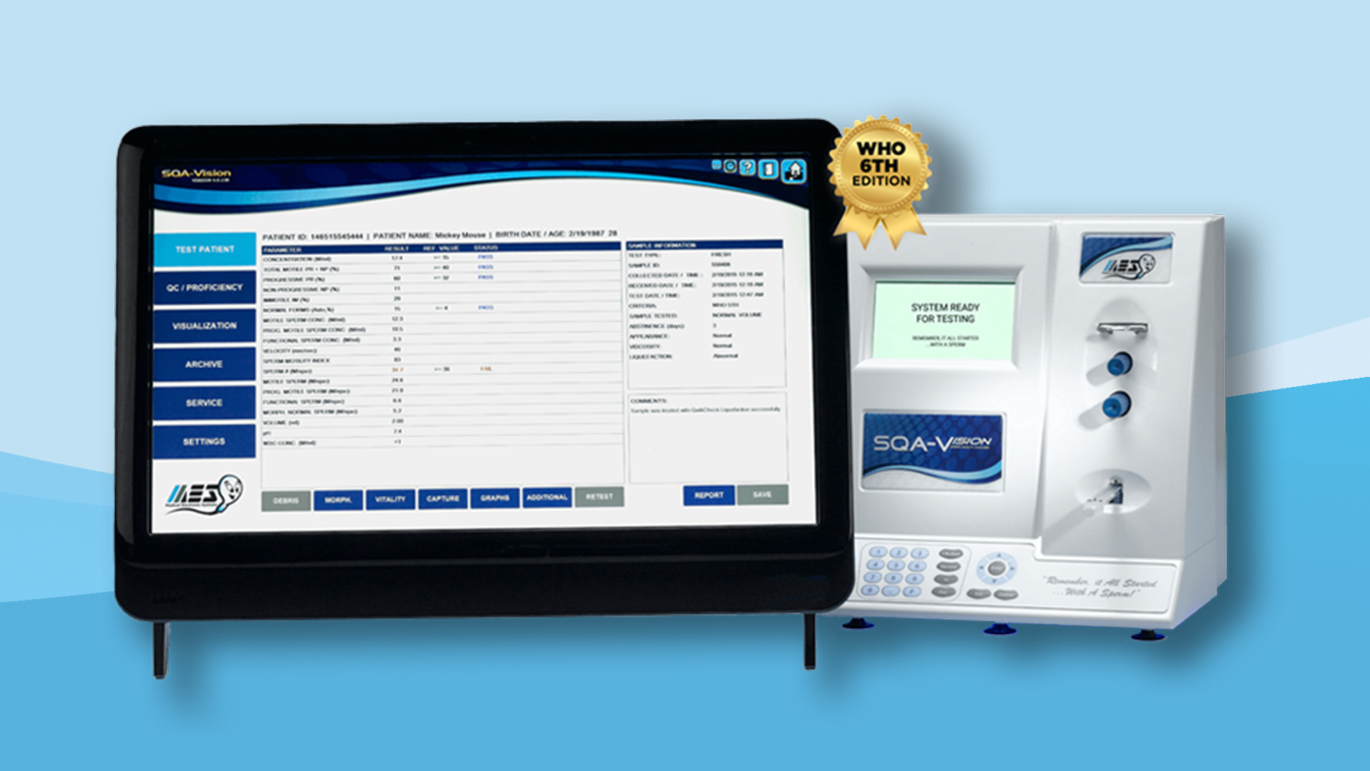 SQA-Vision automated semen analyzer — fast and simple semen testing, on-screen visualization, 5th Edition of WHO sperm parameters
