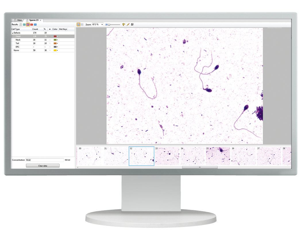 The full picture in Sperm Analysis<br> SQA-iO and Vision Sperm